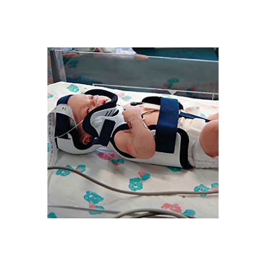 Ossur Papoose Infant Spinal Immobilizer