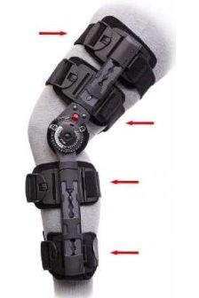 Donjoy X-ROM Knee Brace Replacement Strap Set
