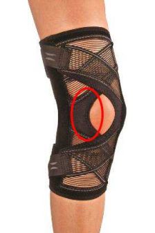 Hely Weber Kneesio Replacement Buttress