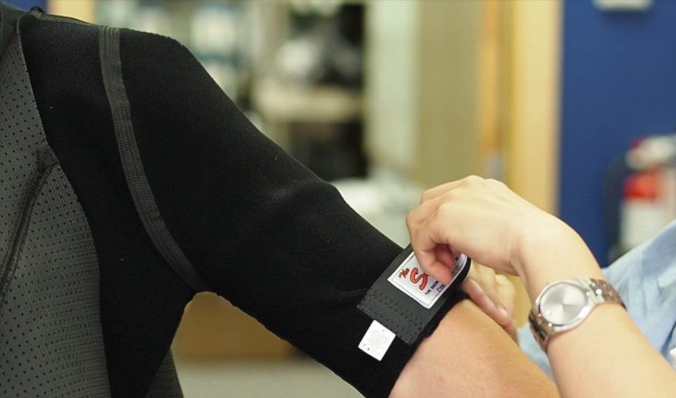 Rehabilitation After Shoulder Subluxation: When to Use a Brace