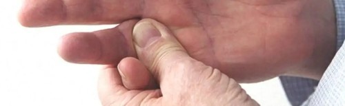 Guide to Finger Sprain Braces  Splints Support