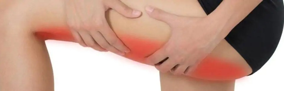 Hamstring Braces & Compression Sleeves