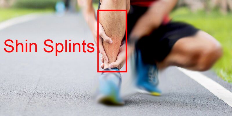 Shin Splints