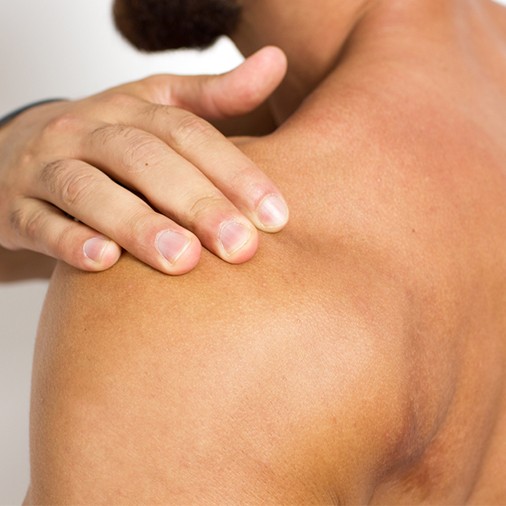 shoulder bursitis