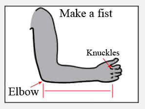 medi Protect Epico ROM Post-Op Elbow Brace