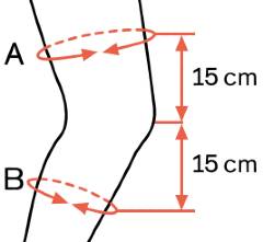 Ottobock Agilium Reactive Knee Brace sizing